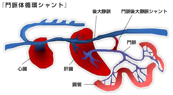 門脈体循環シャント